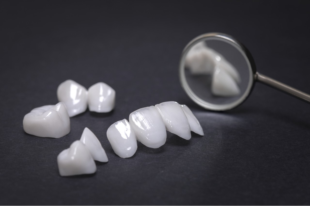 tratamientos de estética dental en vitoria
