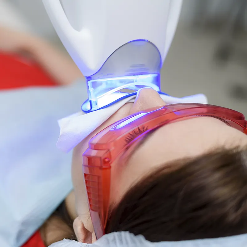 Blanqueamiento dental