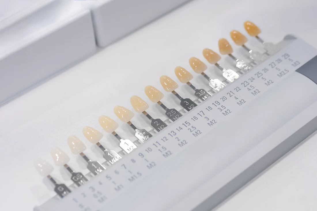 Blanqueamiento dental
