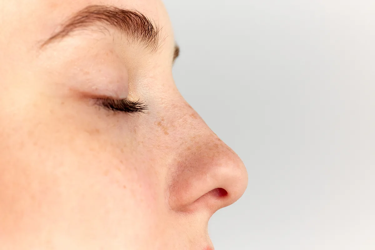 Rinomodelación