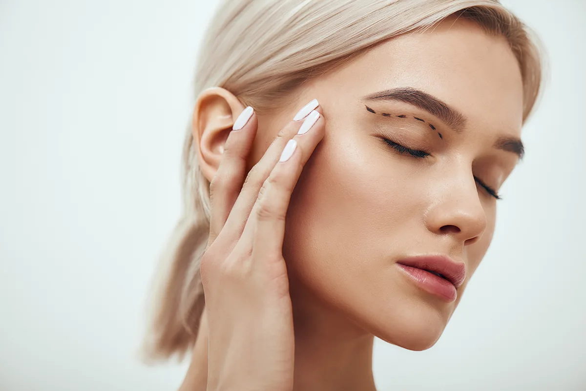 Blefaroplastia