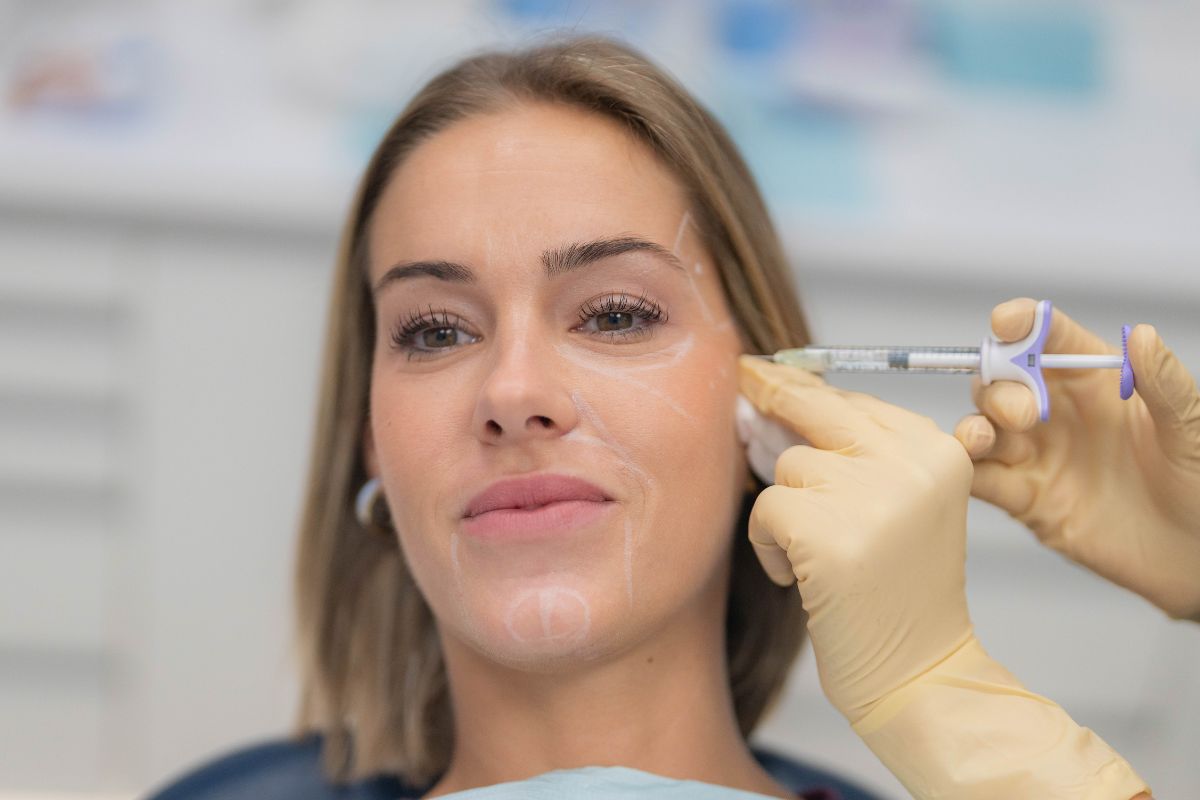 Aplicación de bioestimulador de colágeno en el rostro para mejorar la firmeza y estimular la producción natural de colágeno en clínica de medicina estética en Vitoria-Gasteiz.